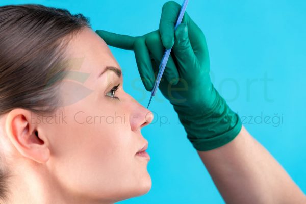 Nasal Bone Correction in Turkey