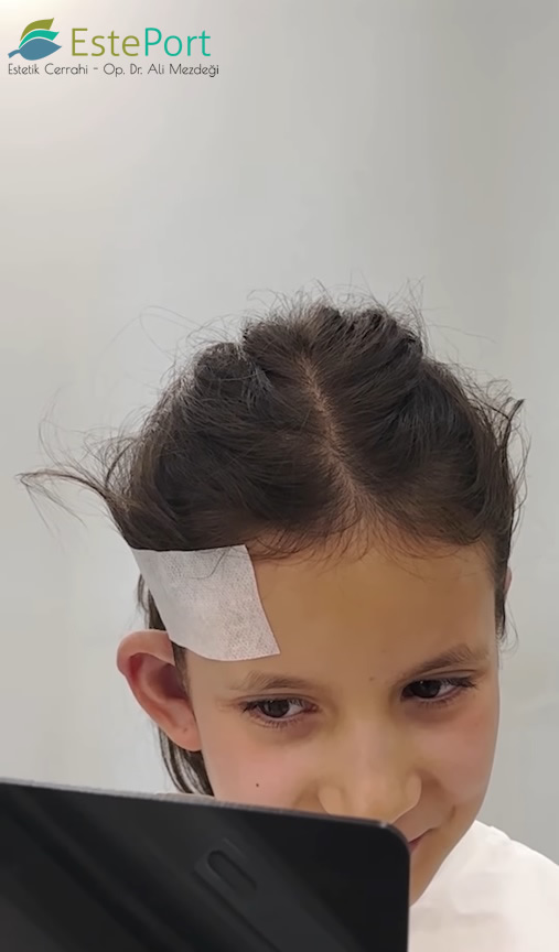 çocuklarda kepçe kulak ameliyatı